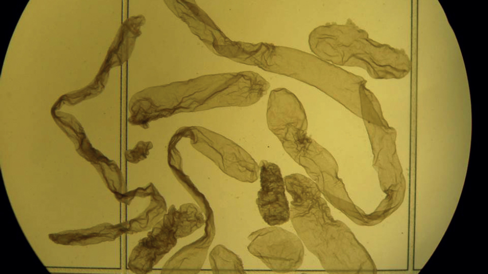 Figure 1. Elongating bovine conceptuses recovered from the same uterus at slaughter on day 14 following transfer of day 7 in vitro produced blastocysts. Note the variation in conceptus length. Multiple embryo transfer studies allow repeated measures of the ability of the uterine environment to support conceptus development and highlight that there is an intrinsic oocyte/embryo component to elongation, as reflected in the variation in conceptus size from the same uterus.